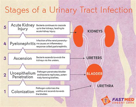 what stds are similar to uti